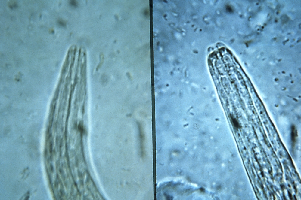 photomicrograph-depicts-the-mouth-parts-hookworm-larvae