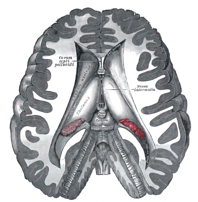 dissection showing ventricles of brain human anatomy